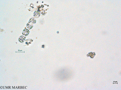 phyto/Thau_Lagoon/THAU_station1/GELAMED 2010/Melosira nummuloides(copy)_thumb.jpg